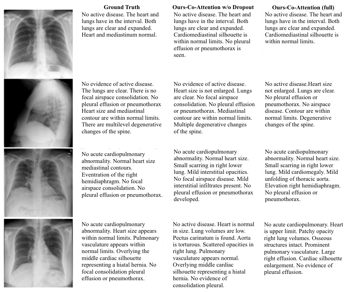 Chest x ray report generation result